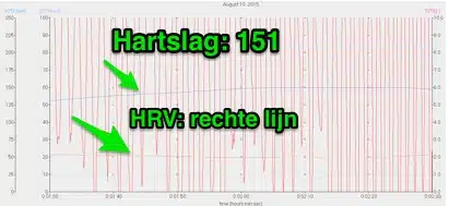 HRV tijdens Wim Hof